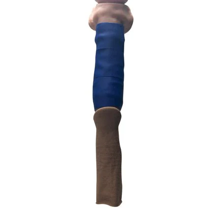 Passive Healing Sleeve Kit - Image 11