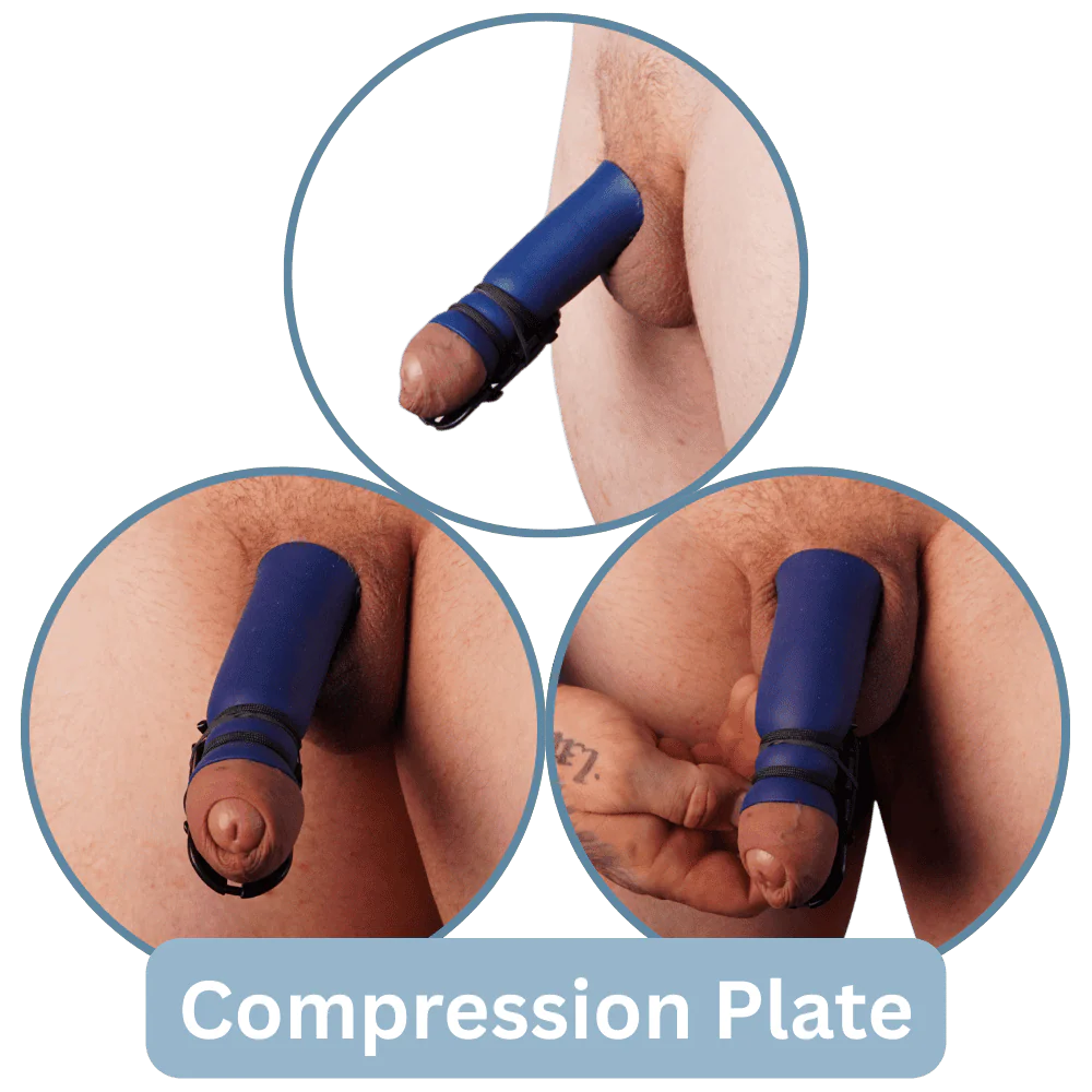 Passive Healing Sleeve Kit - Image 3