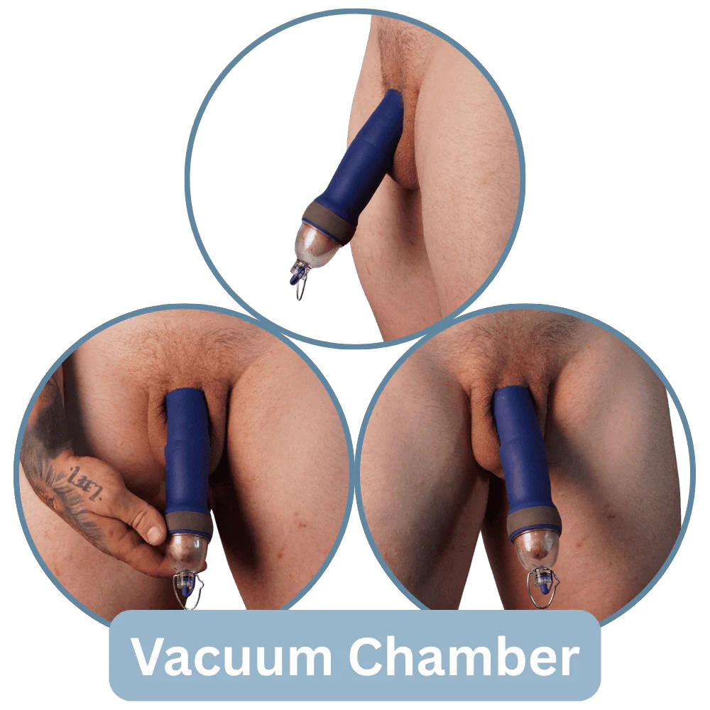 Passive Healing Sleeve Kit - Image 4