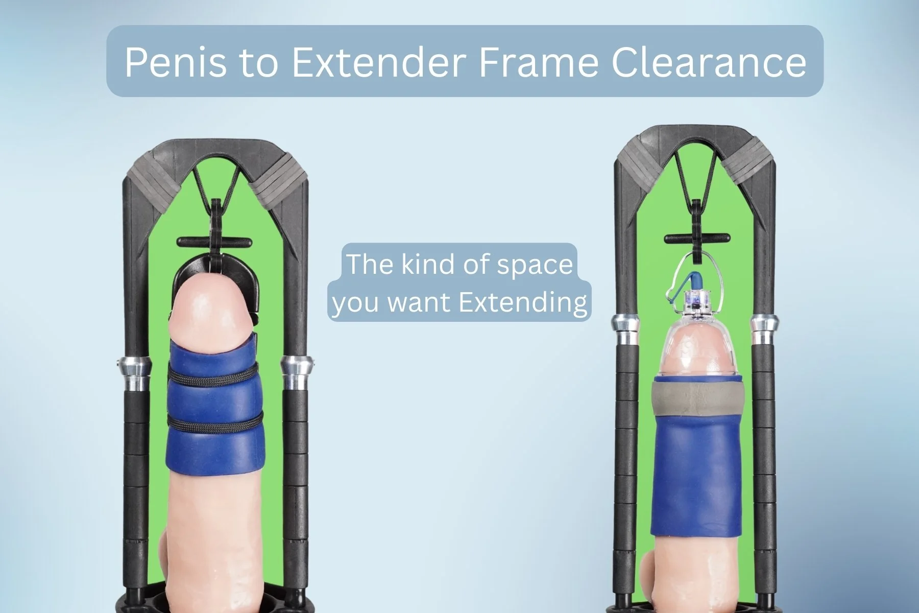 Extender + Stretcher Package - Image 21